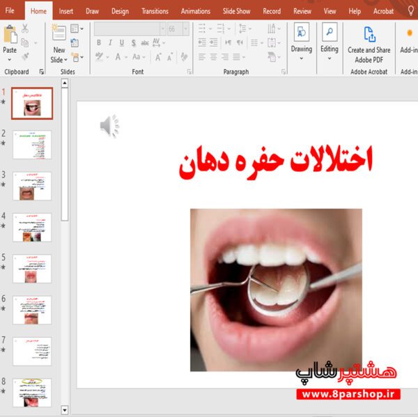 پاورپوینت اختلالات حفره دهان